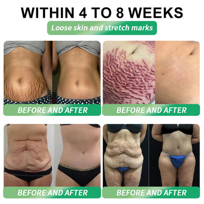 💡𝑶𝒇𝒇𝒊𝒄𝒊𝒂𝒍 𝑺𝒕𝒐𝒓𝒆 | 💯Divifit®US 𝐺𝐿𝑃-𝟏  𝑺𝒊𝒙-𝒊𝒏-𝑶𝒏𝒆 𝑯𝒆𝒂𝒍𝒕𝒉 𝑺𝒐𝒍𝒖𝒕𝒊𝒐𝒏 𝑶𝒓𝒂𝒍 𝑳𝒊𝒒𝒖𝒊𝒅  (𝐉𝐮𝐬𝐭 𝐨𝐧𝐜𝐞 𝐚 𝐝𝐚𝐲, 𝐯𝐢𝐬𝐢𝐛𝐥𝐞 𝐜𝐡𝐚𝐧𝐠𝐞𝐬 𝐢𝐧 𝟕 𝐝𝐚𝐲𝐬） ✅ 𝐅𝐨𝐫 𝐨𝐛𝐞𝐬𝐢𝐭𝐲, 𝐜𝐚𝐫𝐝𝐢𝐨𝐯𝐚𝐬𝐜𝐮𝐥𝐚𝐫 𝐡𝐞𝐚𝐥𝐭𝐡, 𝐝𝐢𝐚𝐛𝐞𝐭𝐞𝐬, 𝐬𝐥𝐞𝐞𝐩 𝐚𝐩𝐧𝐞𝐚, 𝐆𝐮𝐭 𝐇𝐞𝐚𝐥𝐭𝐡, 𝐣𝐨𝐢𝐧𝐭 𝐢𝐬𝐬𝐮𝐞𝐬, 𝐚𝐧𝐝 𝐦𝐨𝐫𝐞