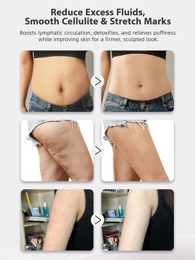 Heated Body Sculpting Massager – Smooth, Firm & Detox Your Skin at Home